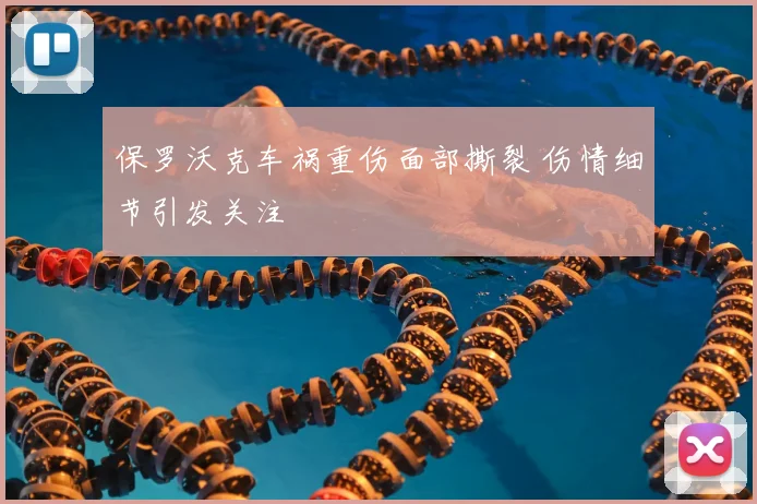 保罗沃克车祸重伤面部撕裂 伤情细节引发关注